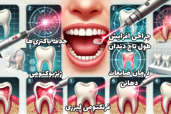 جراحی لثه با لیزر